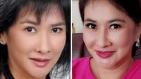 Perubahan wajahnya dari 2009 lalu hingga 2019. Dok. Instagram/yurikeprastika7