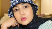 Fenita Arie pernah operasi plastik akibat salah satu bagian tubuhnya tersiram air panas. Namun momen tersebut justru membawanya ke jalan hijrah. (Foto: Instagram @fenitarie)