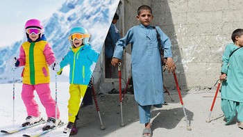 Anak-anak ini terkena bom mortir saat berjalan ke sekolah tahun lalu. Foto: Uğur Gallenkuş