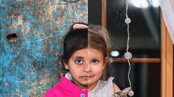 Noha Abu Mesleh, 5 tahun, terlihat di dalam rumahnya di kamp pengungsi Nuseirat di Jalur Gaza tengah. Foto: Uğur Gallenkuş