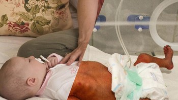 Di Kota Hajjah di Yaman, MSF (Doctors Without Borders) telah membantu bangsal bersalin sejak Agustus 2015. Bayi baru lahir ini sudah memiliki cerita besar di belakangnya: ibunya, Asima, 21 tahun, menderita eklampsia sejak bulan kelima kehamilannya. . Pada bulan kedelapan, dia mengalami sakit kepala parah dan bengkak di anggota tubuhnya. Para dokter harus melakukan operasi caesar untuk menyelamatkan nyawanya dan bayinya. 13 Agustus 2018. Foto: Uğur Gallenkuş