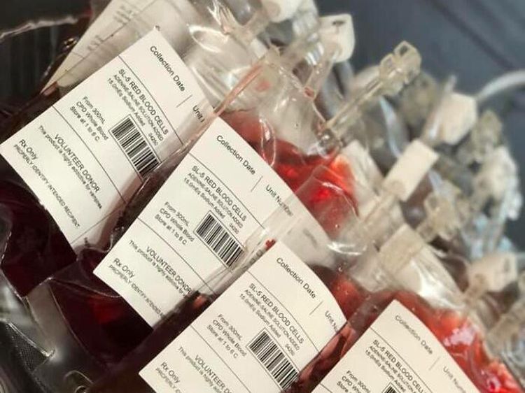 Ngeri Sedap! Pesta Ulang Tahun Ini Dipenuhi Kue Darah hingga Tengkorak