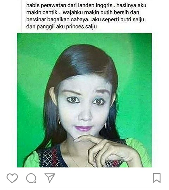 Udah perawatan jauh-jauh nih sampai ke Inggris. Pasti biayanya mahal yaa.. tapi kok mukanya malah jadi belang sama warna kulit leher dan tangannya sih.. Foto: Facebook