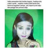 Udah perawatan jauh-jauh nih sampai ke Inggris. Pasti biayanya mahal yaa.. tapi kok mukanya malah jadi belang sama warna kulit leher dan tangannya sih.. Foto: Facebook