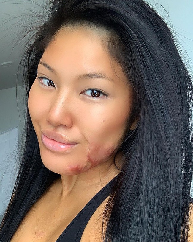 Wanita tersebut mengalami insiden saat pertunjukkan fire dancing yang meninggalkan luka permanen di wajah cantiknya. Foto: dok. Instagram @sophirelee