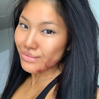 Wanita tersebut mengalami insiden saat pertunjukkan fire dancing yang meninggalkan luka permanen di wajah cantiknya. Foto: dok. Instagram @sophirelee