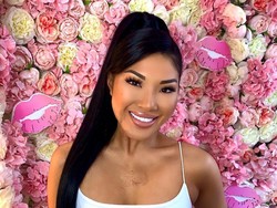 Foto: Mantan Penari Api yang Tetap Cantik Meski Punya Luka Bakar