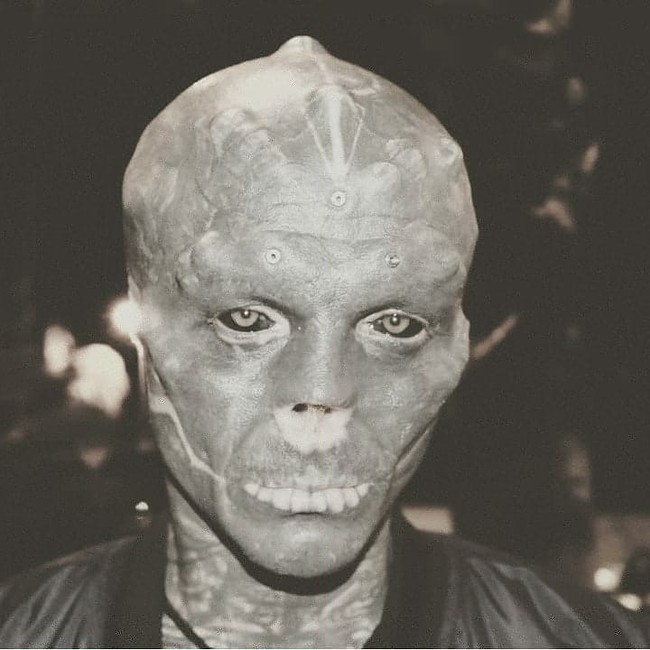 Anthony juga melakukan operasi pengangkatan hidung. Ia hanya memiliki lubang hidung saja. Operasi plastik ekstrem tersebut bernama rhinotomy yang dilakukannya secara ilegal di Barcelona. Foto: Instagram