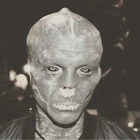 Anthony juga melakukan operasi pengangkatan hidung. Ia hanya memiliki lubang hidung saja. Operasi plastik ekstrem tersebut bernama rhinotomy yang dilakukannya secara ilegal di Barcelona. Foto: Instagram