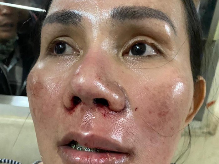 Andrena Isa Zega dipukul orang tak dikenal