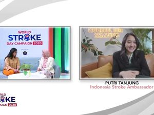 Cegah Stroke Sejak Dini, Simak Tips Hidup Sehat ala Putri Tanjung!