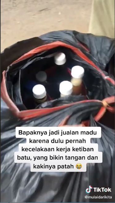 Perjuangan Hidup Penjual Madu, Alami Patah Tulang dan Tak Punya Tempat Tinggal