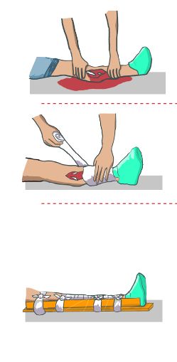Cara melakukan pertolongan pertama saat terjadi kecelakaan.