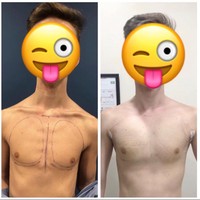 Sudah melakukan banyak hal dan mengeluarkan banyak uang, Tyler pun mengaku tidak berencana untuk berhenti dalam waktu dekat. Tapi tak seperti beberapa orang lain yang terobsesi operasi plastik, Tyler mengaku ingin tampilan yang natural dan tidak seperti alien. Foto: Instagram @tylerkd97