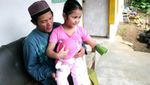 Anak Guru Ngaji di Sukabumi Ini Rela Menabung Demi Tangan Palsu