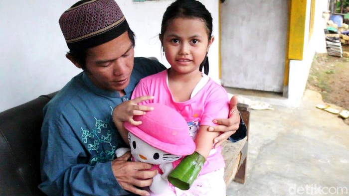 Senyum Meysa Widiya mengembang saat melihat kedatangan awak media di kediamannya, Kampung Rancaseel, RT 18 RW 9 Desa/Kecamatan Lengkong, Kabupaten Sukabumi. Gadis berusia 7 tahun itu rela menabung demi mendapatkan tangan palsu. Tangan kiri gadis itu putus, setelah sebelumnya patah karena terjatuh pada pertengahan bulan Agustus 2020 lalu. Darin (40) sang ayah hanya seorang guru ngaji, sedikit rejeki yang ia peroleh hanya cukup untuk membayar listrik dan makan sehari-hari istri dan tiga anaknya termasuk Meymey, panggilan akrab Meysa.
