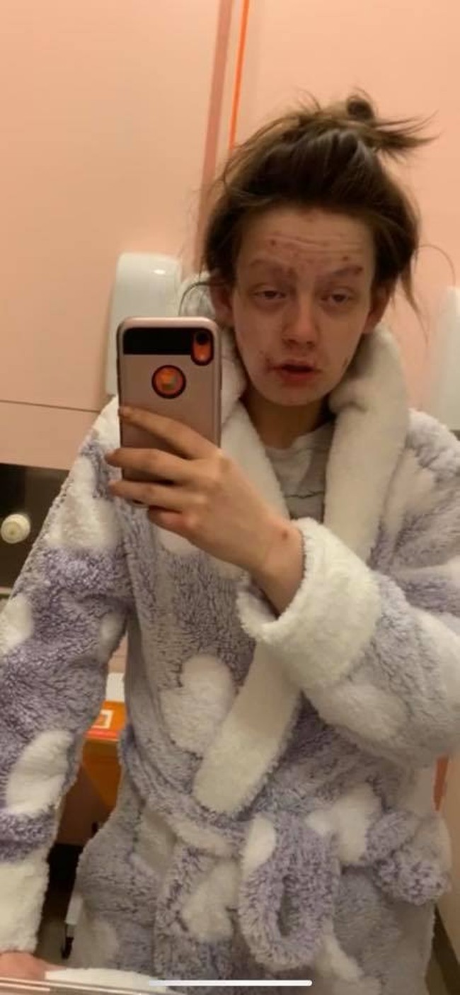 Aku sekarang benar-benar bersih baik dari crack kokain dan heroin selama empat tahun. Aku benar-benar bersih setelah menjadi pecandu selama dua tahun, setiap hari. Aku butuh waktu lama untuk merasa berharga dan aku melakukannya dengan baik dan merasa bangga dengan seberapa jauh aku melangkah, ujarnya dilansir Dailymail. Foto: Facebook Demi-Nicole Dunlop