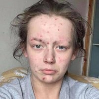 Demi-Nicole Dunlop sebelumnya adalah seorang pecandu selama dua tahun yang membuat penampilannya lusuh. Berusaha untuk sembuh selama empat bulan terakhir, ia pun kini terlihat cantik bak selebriti yang bikin kagum netizen. Foto: Facebook Demi-Nicole Dunlop