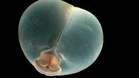 Cacing pantat babi hidup di kedalaman 900-1.2000 meter. (Karen Osborn/MBARI)