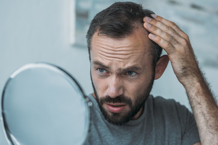 Kopi untuk Atasi Rambut Rontok Pada Pria