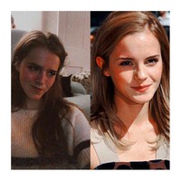 Ella memang sering mengunggah foto-foto ala Emma Watson di Instagram dan Reddit. Ia sendiri sebenarnya tidak merasa mirip dengan aktris 30 tahun tersebut tapi selalu dibilang demikian sejak kecil. Foto: Instagram @ellanortonnnn