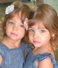 Ava Marie dan Leah Rose adalah kembar yang sempat viral. Begini transformasinya semakin besar.
