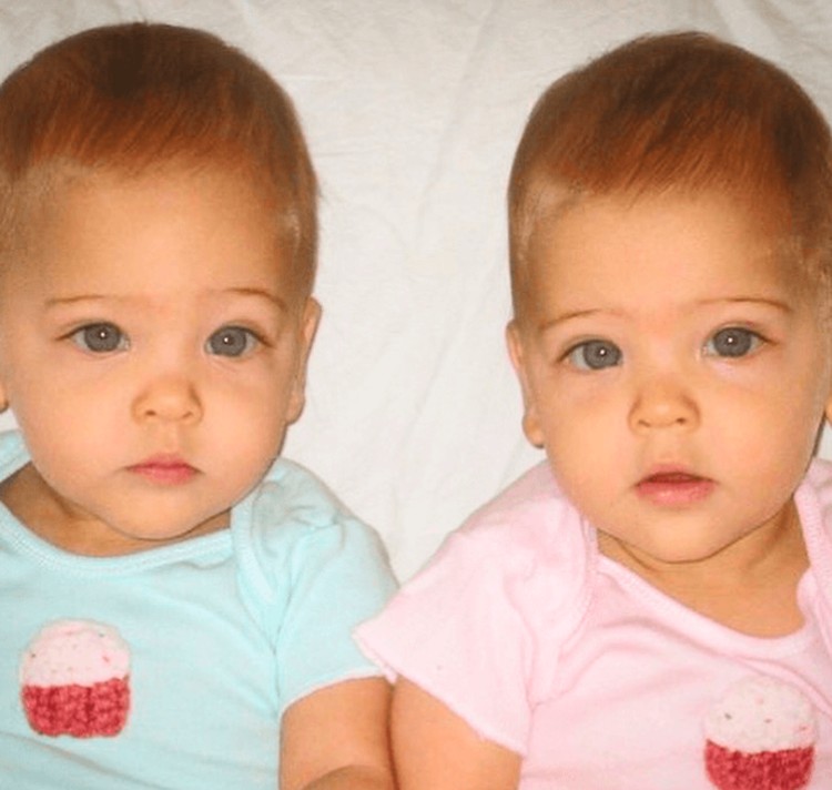 Ava Marie dan Leah Rose adalah kembar yang sempat viral. Begini transformasinya semakin besar.