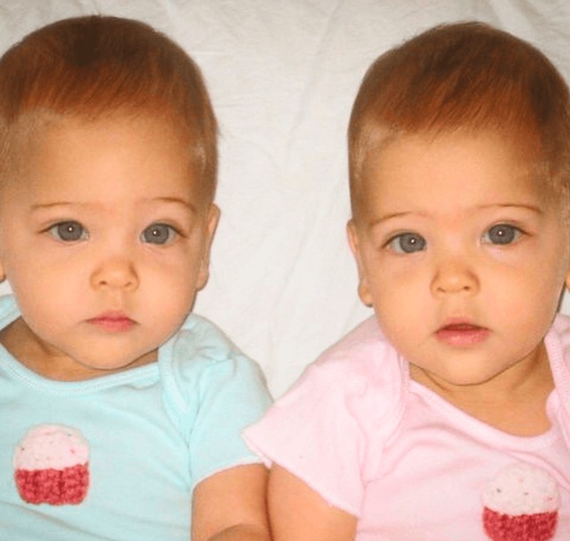 Ava Marie dan Leah Rose adalah kembar yang sempat viral. Begini transformasinya semakin besar.