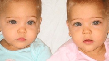 Ava Marie dan Leah Rose adalah kembar asal Amerika yang lahir pada 7 Juli 2010. Foto: via Daily Forest