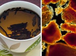 Begini Rupanya Kulit Hiu, Brokoli Hingga Rambut DIlihat Super Dekat