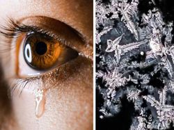 Begini Rupanya Kulit Hiu, Brokoli Hingga Rambut DIlihat Super Dekat