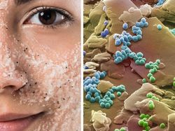 Begini Rupanya Kulit Hiu, Brokoli Hingga Rambut DIlihat Super Dekat