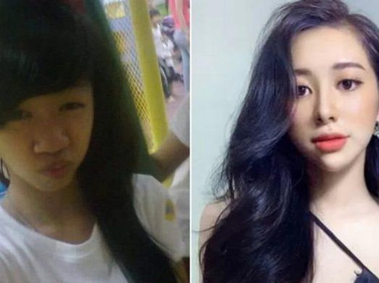 7 Potret Transformasi Wanita Usai Putus dan Lakukan Oplas, Beda Banget!