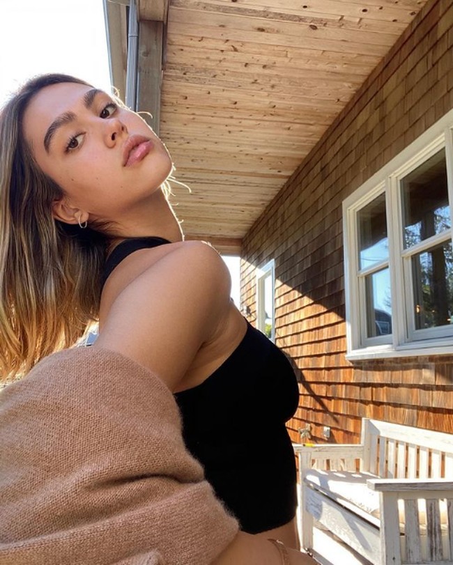 Dampak lain, tindakan operasi pengecilan payudara juga dijalani. Amelia mengaku shock. Namun, ia merasa sangat bersyukur jiwanya masih bisa terselematkan. (Foto: Instagram/@ameliagray)