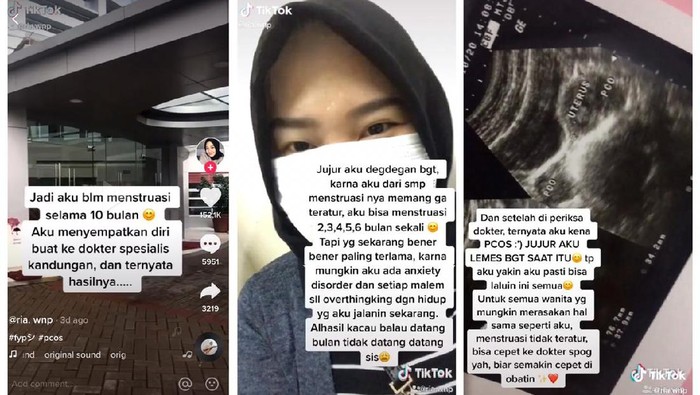 Viral Wanita Idap PCOS, Baru Ketahuan Setelah 10 Bulan Tidak Haid