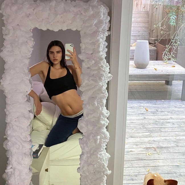 Bukan untuk kepentingan estetika, melainkan karena alasan kesehatan. Bercerita soal pengalaman tersebut di podcast Skinny Confidential Him and Her, Amelia mengaku operasi dilakukan setelah ia mengalami radang dan mastitis (infeksi jaringan payudara) pada payudara kiri yang membuatnya tampak bengkak dan besar. (Foto: Instagram/@ameliagray)