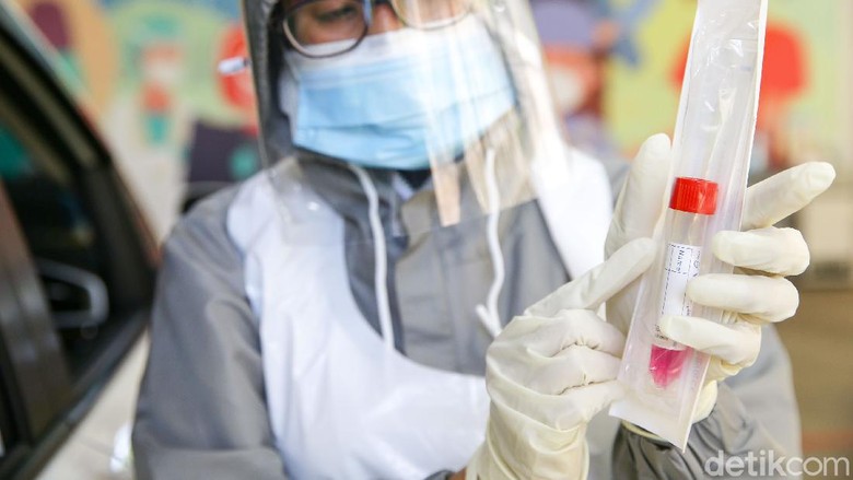 Mengintip Dapur Test SWAB di RSPI Bintaro Petugas melakukan uji Swab Antigen atau PCR di Swab Drive Thru Rumah Sakit Pondok Indah (RSPI) Bintaro, Tangerang, Jumat (20/11/2020). Dengan penyediaan fasilitas ini membuat masyarakat lebih nyaman dan aman tanpa harus kontak dengan banyak orang.