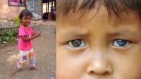 Hanindya Putri Dinanti (2) berpose di rumahnya, di Kelurahan Korong Gadang, Kecamatan Kuranji, Kota Padang, Sumatera Barat. Kebanggaan tersebut kian menular ke sejumlah orang-orang Minangkabau yang bermata biru dan keturunannya yang merantau ke sejumlah daerah di Indonesia. 