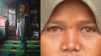 Orangtua Fahri dan Gofar, Yulia Eliza (29), yang memiliki iris mata berwarna cokelat terang itu mengaku kondisi ekonomi keluarganya serba kekurangan sehingga tidak mampu untuk membeli alat pendengaran untuk anaknya.
