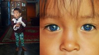 Orangtua dari kedua anak tersebut, Jainal (33) mengaku, menerima saran dokter agar menyekolahkan Dani setahun lagi di SLB. Setelah itu, baru ditinjau kembali apakah sudah bisa menggunakan alat dengar atau belum.