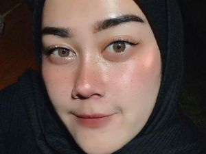 Cerita Dramatis Ibu di Cimahi Tersangkut Besi Drainase Selama 1 Jam