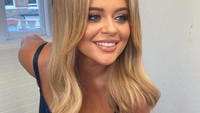 Emily Atack menjadi sorotan karena pengakuannya yang mengejutkan. Dok. Instagram/emilyatackofficial