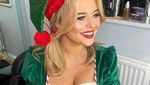 Emily Atack The Real Pelakor yang Pernah Threesome dengan Pasutri