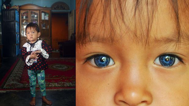 Alika (2,5) berpose di rumahnya, di Jorong Padang Data, Nagari Simawang, Kecamatan Rambatan, Kabupaten Taah Datar, Sumatera Barat, Selasa (20/10/2020). Alika memiliki sepasang iris mata bewarna biru.