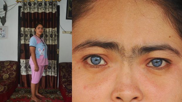 Restu Ayu (29) berpose di rumahnya, di Jorong Dalam Koto, Nagari Taeh Baruah, Kecamatan Payakumbuh, Kabupaten Limapuluhkota, Sumatera Barat, Rabu (21/10/2020). Restu Ayu yang merupakan seorang ibu rumah tangga itu memiliki dua iris mata bewarna biru yang kemudian ia turunkan ke anak keduanya.