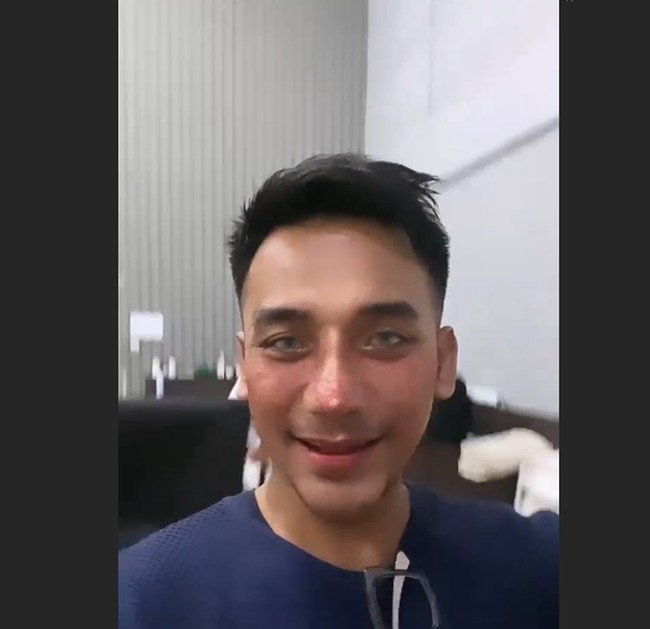 Perjalanan Bubah melakukan rhinoplasty pun cukup panjang. Dia telah melakukan operasi hidung sebanyak tiga kali.Foto: dok. Instagram