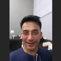 Perjalanan Bubah melakukan rhinoplasty pun cukup panjang. Dia telah melakukan operasi hidung sebanyak tiga kali.Foto: dok. Instagram