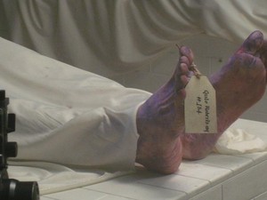 Dikira Sudah Meninggal, Seorang Pria Hidup Lagi Saat Akan Diformalin
