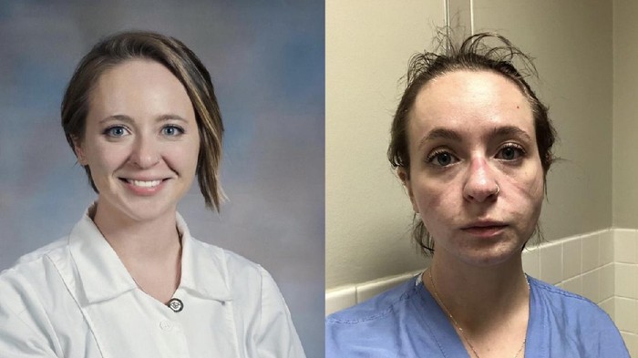 Foto before-after perawat di garis depan penanganan COVID-19