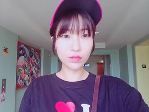 Sering Di-bully karena Penampilan, Artis Korea Ini Akhirnya Jalani Oplas